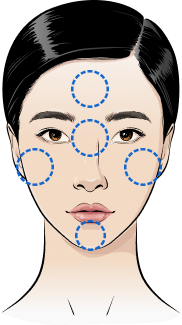 안면윤곽 부위