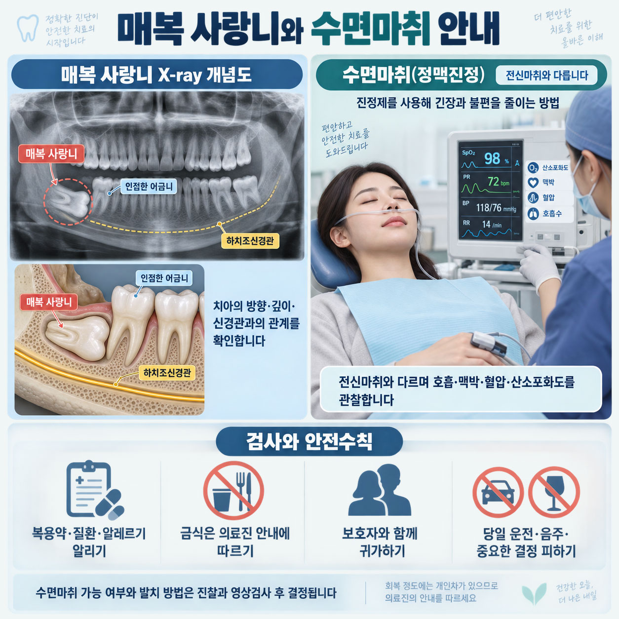 강남 사랑니 발치 매복 사랑니 위치와 수면마취 진정법 안내 설명