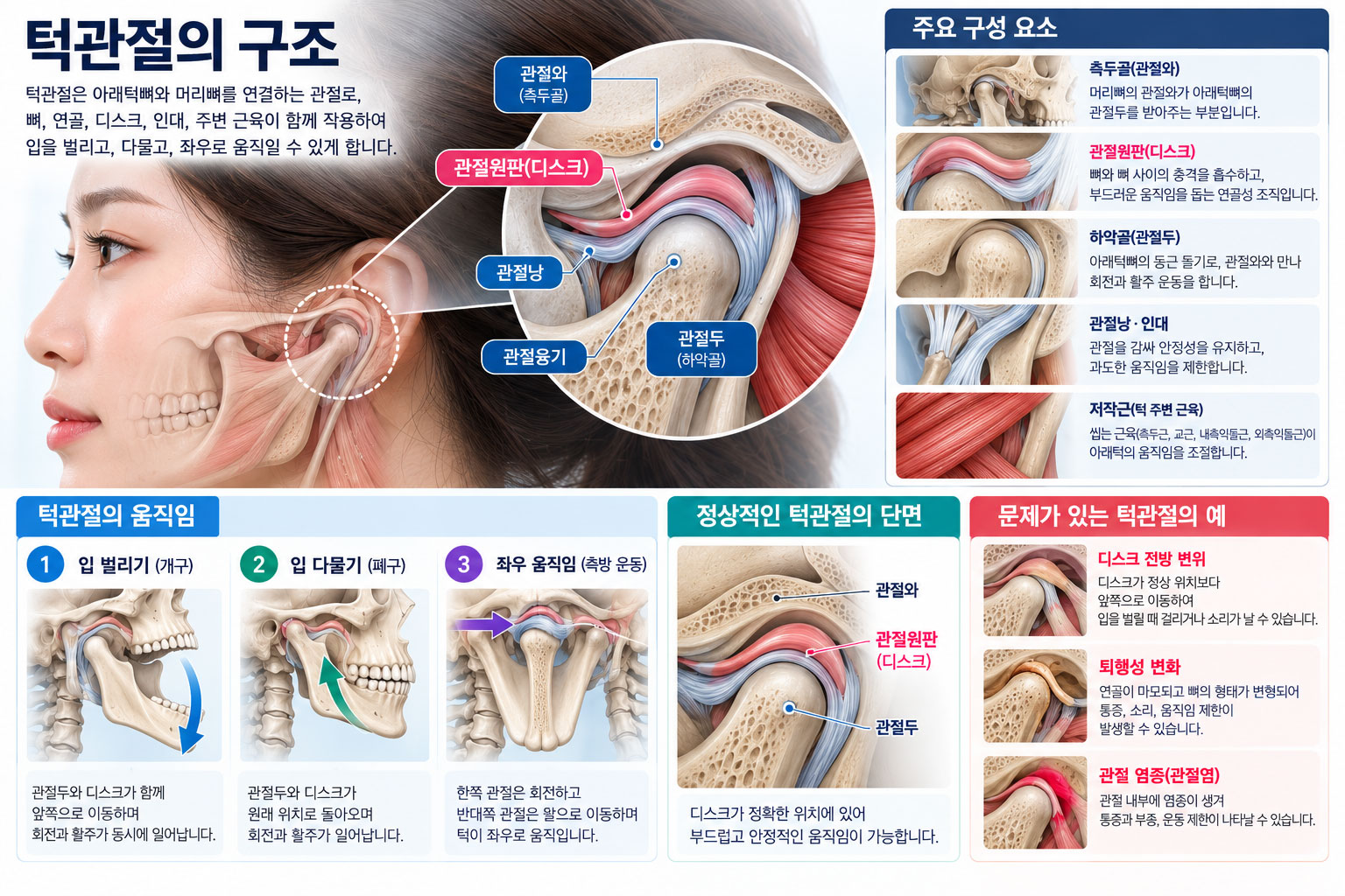 강남 턱관절 장애 턱관절 구조와 디스크 관절 근육 위치를 보여주는 설명도