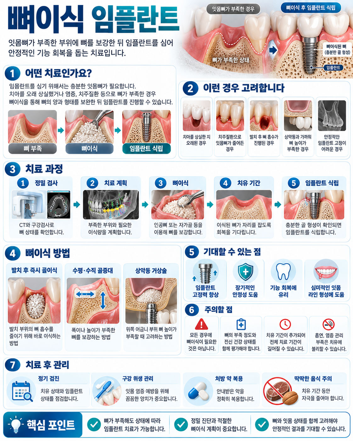 강남 뼈이식 임플란트 잇몸뼈 골이식과 상악동 거상술로 임플란트 토대를 만드는 과정 설명