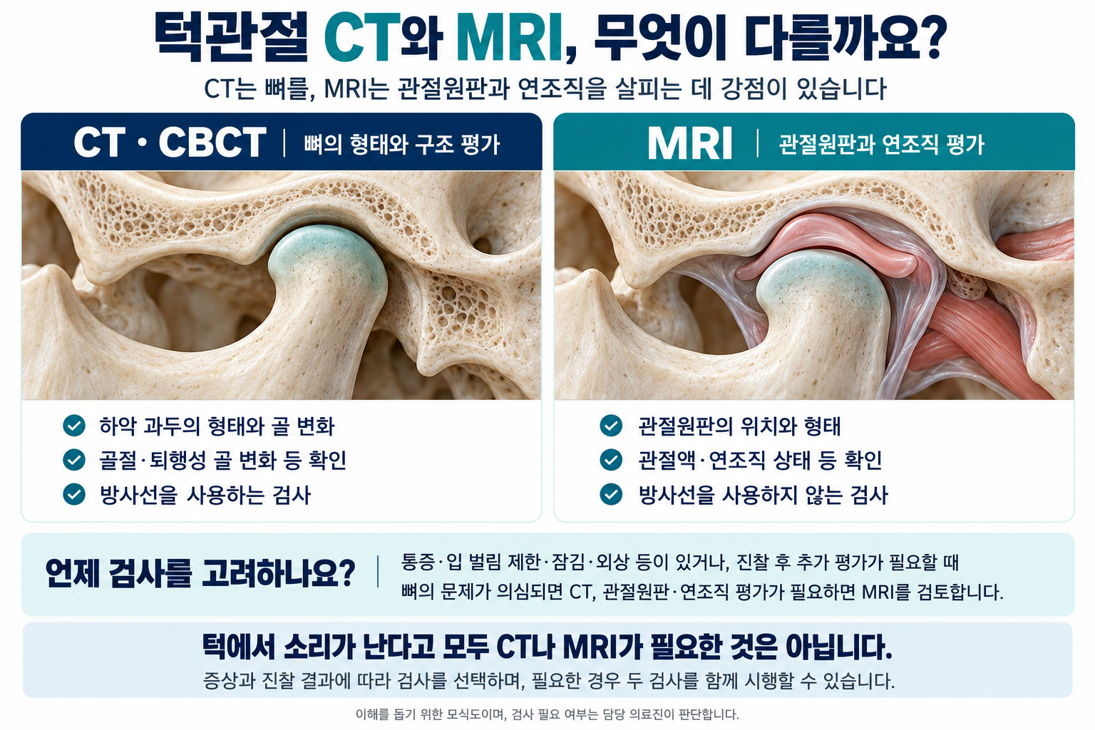강남 턱관절 MRI와 CT 차이 뼈와 관절 디스크를 보는 영상 검사 비교 설명