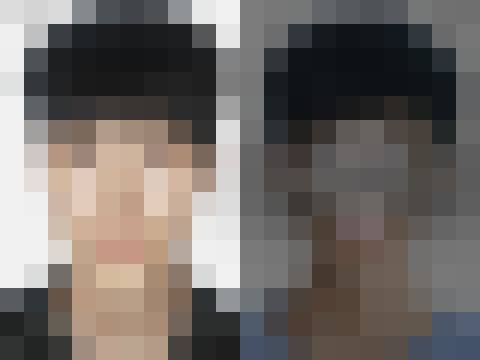 양악수술 (2Jaw) (회원 전용)