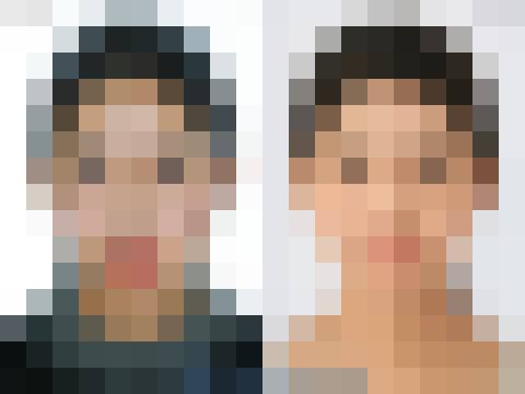 Before & After case 4