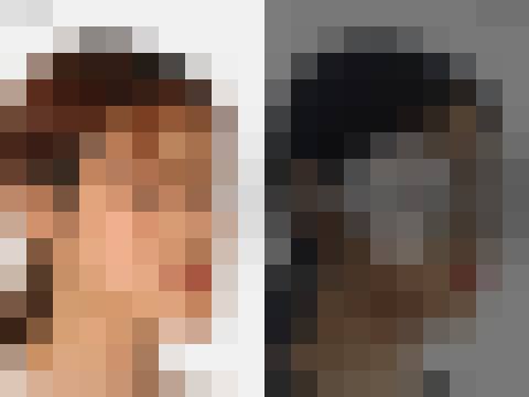 양악수술 (2Jaw) (회원 전용)