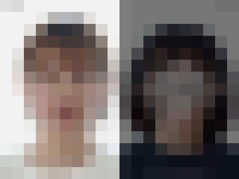 양악수술 (2Jaw) (회원 전용)