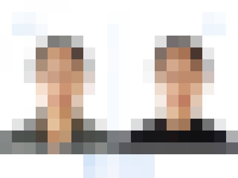 양악수술 (회원 전용)
